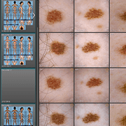 D2 Dermagraphix 2